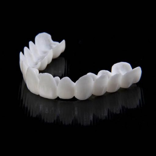 Snap-On Smile Veneers (Upper & Lower)