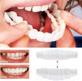 Na Smile Veneers (včetně horní a dolní čelisti)