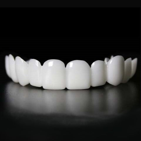 Faccette Snap-On Smile (Superiori e Inferiori)