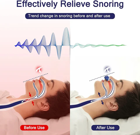 Micro CPAP přístroj na spánkovou apnoe pro cestování a proti chrápání – alternativa k CPAP