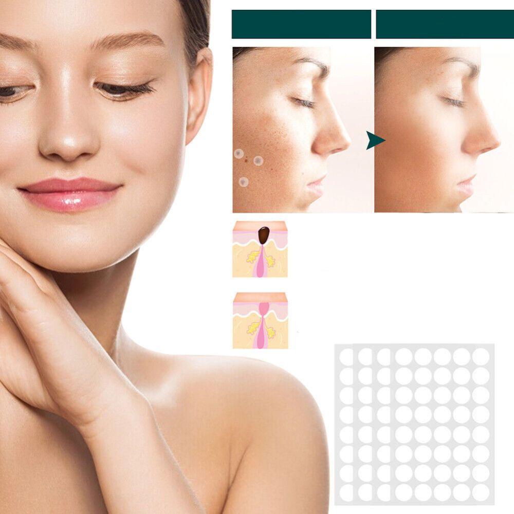 SkinClear Skin Tag Remover | Patches for Removing Skin Tags & Warts | Hydrocolloid Technology | Painless & Discreet | For All Skin Types | 120 Pieces