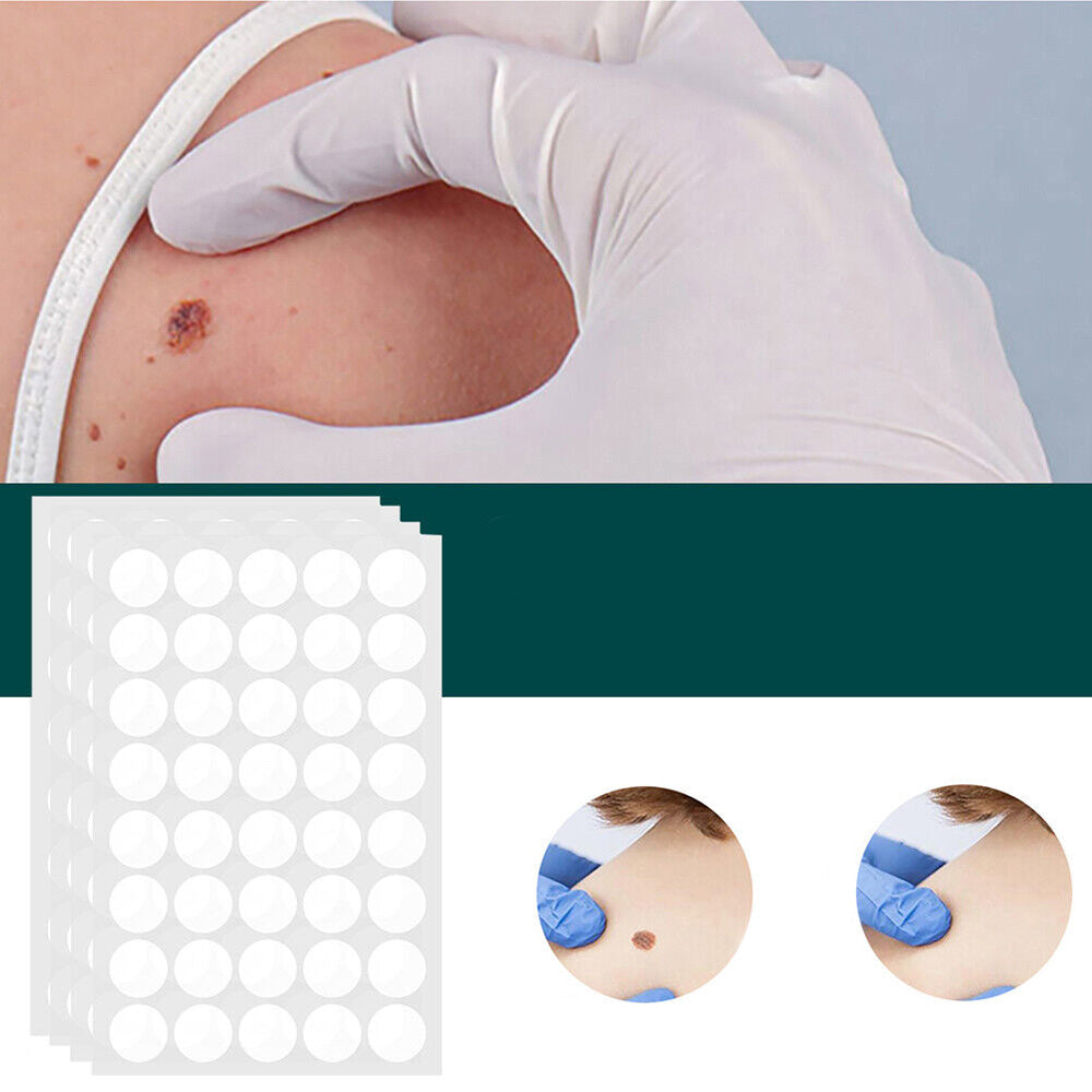 SkinClear Skin Tag Remover | Patches for Removing Skin Tags & Warts | Hydrocolloid Technology | Painless & Discreet | For All Skin Types | 120 Pieces