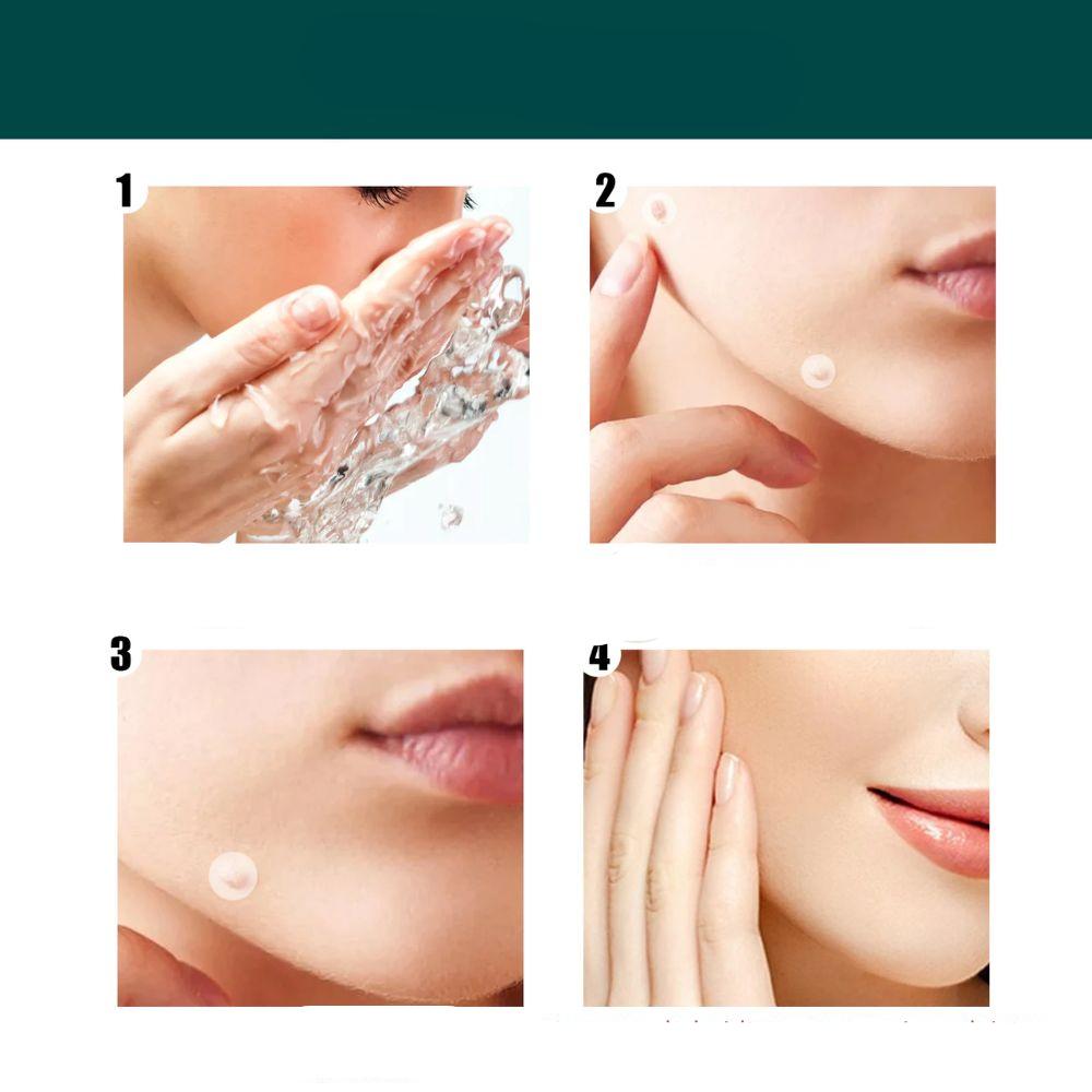 SkinClear Skin Tag Remover | Patches for Removing Skin Tags & Warts | Hydrocolloid Technology | Painless & Discreet | For All Skin Types | 120 Pieces