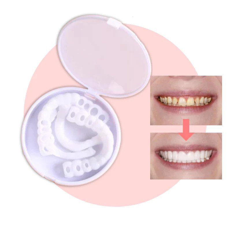 Veneers | Flexible Passform ohne Klebstoff | Für Essen Trinken und Alltag | SnapSmile