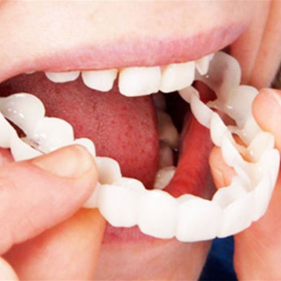 Veneers | Flexible Passform ohne Klebstoff | Für Essen Trinken und Alltag | SnapSmile