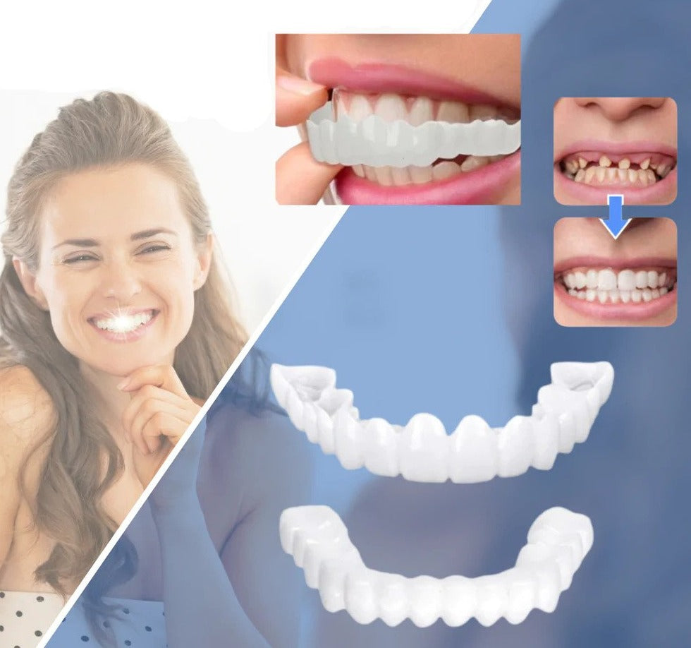 Veneers | Flexible Passform ohne Klebstoff | Für Essen Trinken und Alltag | SnapSmile