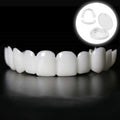 Snap-On Smile Veneers (Upper & Lower)